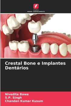 Paperback Crestal Bone e Implantes Dentários [Portuguese] Book
