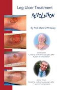 Paperback Leg Ulcer Treatment Revolution Book
