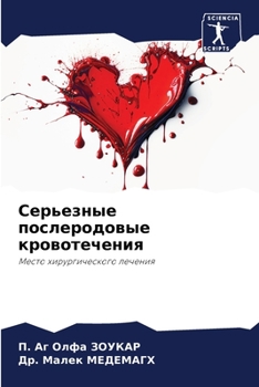 Paperback Серьезные послеродовые & [Russian] Book
