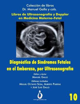 Paperback Diagnostico de Síndromes Fetales en el Embarazo, por Ultrasonografia [Spanish] Book