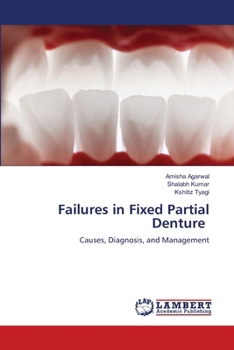 Paperback Failures in Fixed Partial Denture Book