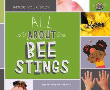 All about Bee Stings - Book  of the Inside Your Body