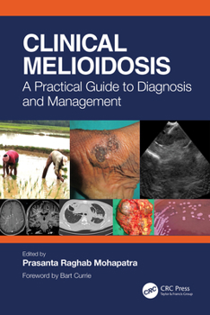 Paperback Clinical Melioidosis: A Practical Guide to Diagnosis and Management Book