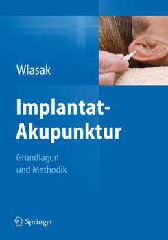 Paperback Implantat-Akupunktur: Grundlagen Und Methodik [German] Book