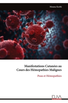 Manifestations Cutanées au Cours des Hémopathies Malignes: Peau et Hémopathies (French Edition)