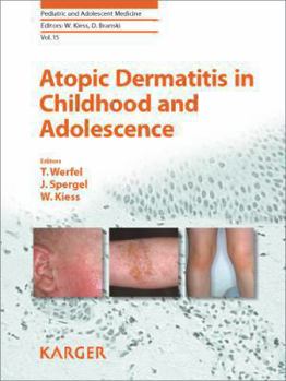 Hardcover Atopic Dermatitis in Childhood and Adolescence (Pediatric and Adolescent Medicine) Book