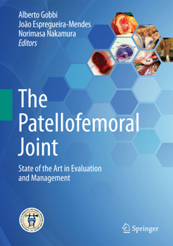 Hardcover The Patellofemoral Joint: State of the Art in Evaluation and Management Book