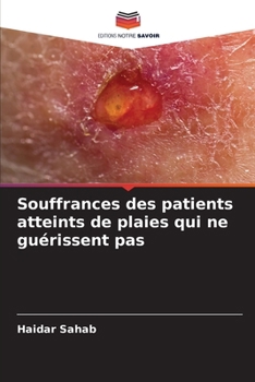 Paperback Souffrances des patients atteints de plaies qui ne guérissent pas [French] Book