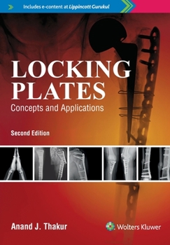 Paperback Locking Plates Concepts And Applications, 2E Book