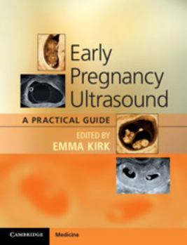 Paperback Early Pregnancy Ultrasound: A Practical Guide Book