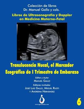 Paperback Translucencia Nucal, el marcador ecografico de I trimestre de Embarazo [Spanish] Book
