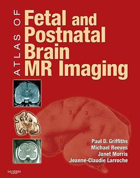 Paperback Atlas of Fetal and Neonatal Brain MR Imaging Book