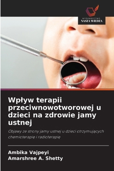 Wplyw terapii przeciwnowotworowej u dzieci na zdrowie jamy ustnej (Polish Edition)