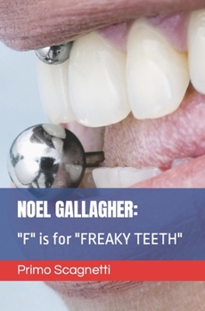 NOEL GALLAGHER: "F" is for "FREAKY TEETH"
