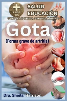 Paperback Gota: forma grave de artritis: Causas, Síntomas, Manejo de Modificadores de Riesgo, Tratamiento, MEDICAMENTOS (APROBADOS MUN [Spanish] Book