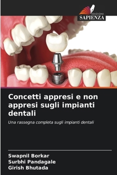 Paperback Concetti appresi e non appresi sugli impianti dentali [Italian] Book