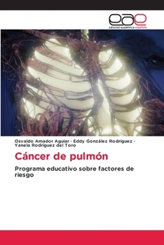 Paperback Cáncer de pulmón [Spanish] Book