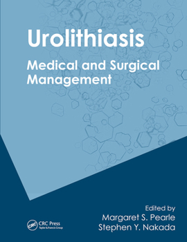 Paperback Urolithiasis: Medical and Surgical Management of Stone Disease Book