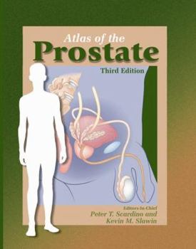 Hardcover Atlas of the Prostate Book