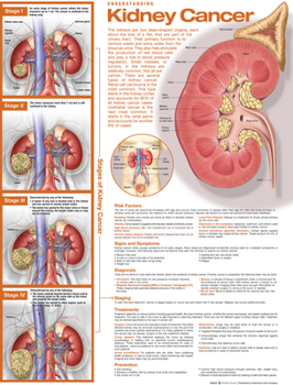 Wall Chart Understanding Kidney Cancer Anatomical Chart Book