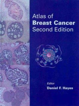 Hardcover Atlas of Breast Cancer Book