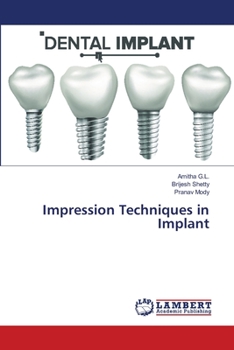 Paperback Impression Techniques in Implant Book
