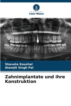 Zahnimplantate und ihre Konstruktion (German Edition)