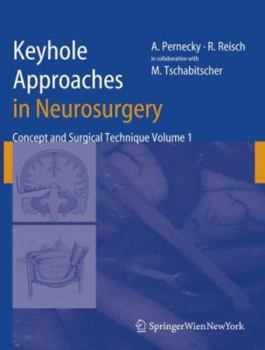 Hardcover Keyhole Approaches in Neurosurgery: Volume 1: Concept and Surgical Technique [German] Book