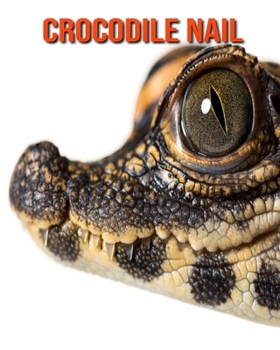 Crocodile Nail: Recueil pour Enfants de Belles Images & d’Informations Intéressantes Concernant les Crocodile Nail (French Edition)