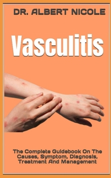 Paperback Vasculitis: The Complete Guidebook On The Causes, Symptom, Diagnosis, Treatment And Management Book