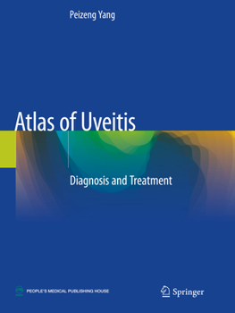 Paperback Atlas of Uveitis: Diagnosis and Treatment Book