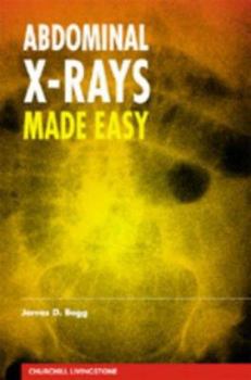 Paperback Abdominal X-Rays Made Easy Book