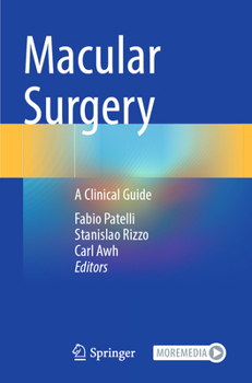 Macular Surgery: A Clinical Guide