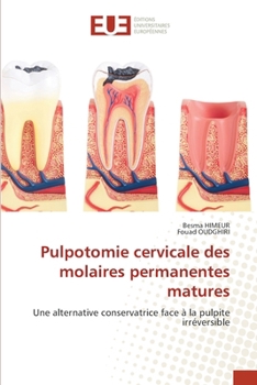 Pulpotomie cervicale des molaires permanentes matures (French Edition)