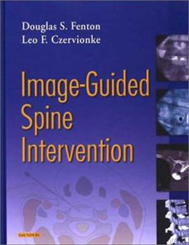 Hardcover Image-Guided Spine Intervention Book