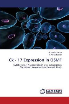 Paperback Ck - 17 Expression in Osmf Book
