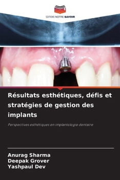 Paperback Résultats esthétiques, défis et stratégies de gestion des implants [French] Book