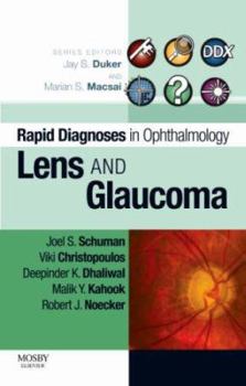 Paperback Rapid Diagnosis in Ophthalmology Series: Lens and Glaucoma Book