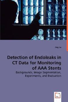 Paperback Detection of Endoleaks in CT Data for Monitoring of AAA Stents Book