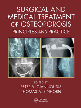 Paperback Surgical and Medical Treatment of Osteoporosis: Principles and Practice Book