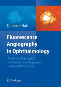 Hardcover Fluorescence Angiography in Ophthalmology Book