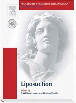 Hardcover Procedures in Cosmetic Dermatology Series: Liposuction: Text with DVD [With DVD-ROM] Book