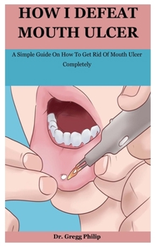 Paperback How I Defeat Mouth Ulcer: A Simple Guide On How To Get Rid Of Mouth Ulcer Completely Book
