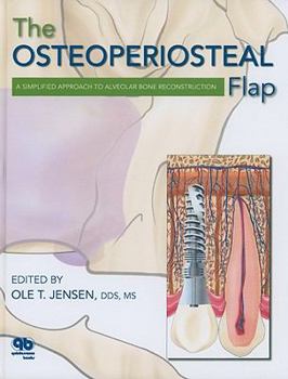 Hardcover The Osteoperiosteal Flap: A Simplified Approach to Alveolar Bone Reconstruction Book