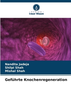Paperback Geführte Knochenregeneration [German] Book