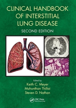 Paperback Clinical Handbook of Interstitial Lung Disease Book