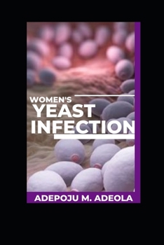 Paperback Women's Yeast Infection: The Power of Coconut Oil in Yeast Treatment Book