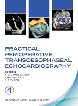 Practical Perioperative Transoesophageal Echocardiography (Oxford Clinical Imaging Guides)