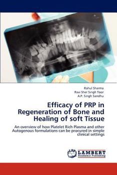 Paperback Efficacy of Prp in Regeneration of Bone and Healing of Soft Tissue Book