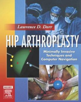 Hardcover Hip Arthroplasty: Minimally Invasive Techniques and Computer Navigation, Text with DVD-ROMS Book